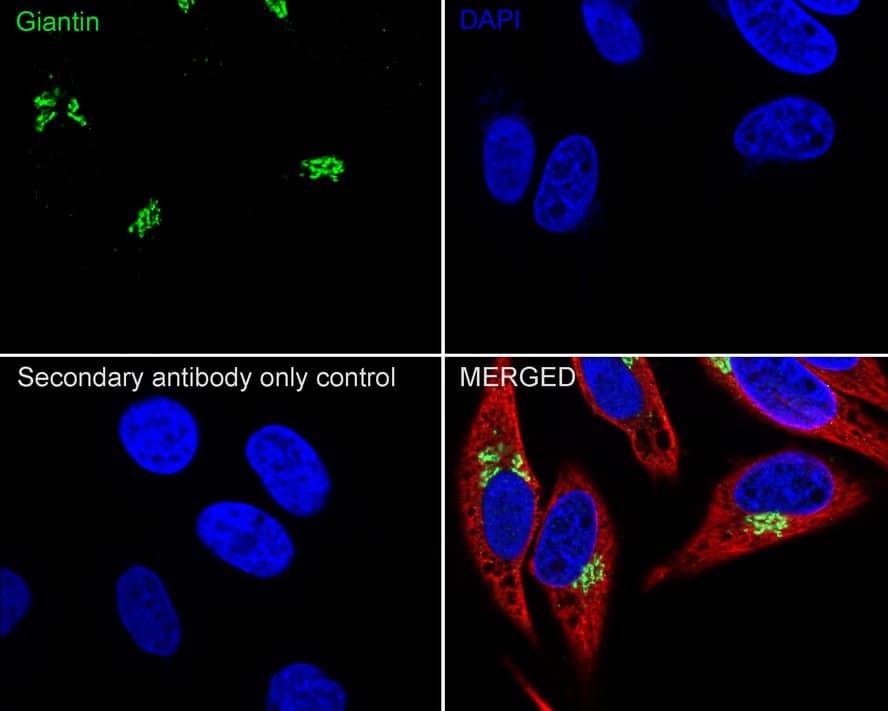 Immunocytochemistry/ Immunofluorescence: GOLGB1/Giantin Antibody (PSH03-86) [NBP3-32381] - Immunocytochemistry analysis of HeLa cells labeling GOLGB1/Giantin with Rabbit anti-GOLGB1/Giantin antibody (NBP3-32381) at 1/100 dilution. Cells were fixed in 4% paraformaldehyde for 20 minutes at room temperature, permeabilized with 0.1% Triton X-100 in PBS for 5 minutes at room temperature, then blocked with 1% BSA in 10% negative goat serum for 1 hour at room temperature. Cells were then incubated with Rabbit anti-GOLGB1/Giantin antibody (NBP3-32381) at 1/100 dilution in 1% BSA in PBST overnight at 4 ℃. Goat Anti-Rabbit IgG H&L (iFluor™ 488) was used as the secondary antibody at 1/1,000 dilution. PBS instead of the primary antibody was used as the secondary antibody only control. Nuclear DNA was labelled in blue with DAPI. Beta tubulin (red) was stained at 1/100 dilution overnight at +4℃. Goat Anti-Mouse IgG H&L (iFluor™ 594) was used as the secondary antibody at 1/1,000 dilution.