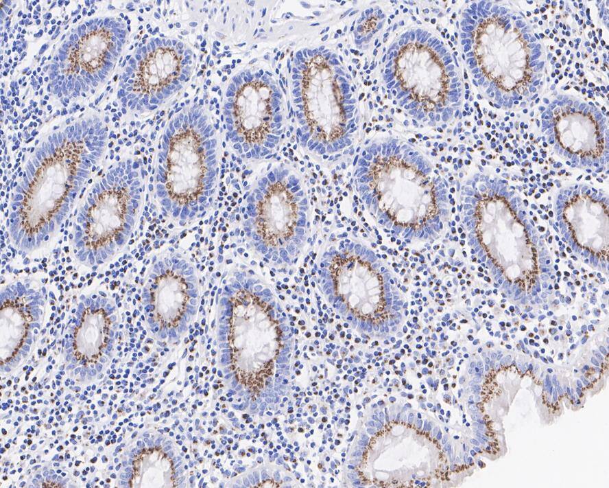 Immunohistochemistry: GOLGB1/Giantin Antibody (PSH03-86) [NBP3-32381] - Immunohistochemical analysis of paraffin-embedded human colon tissue with Rabbit anti-GOLGB1/Giantin antibody (NBP3-32381) at 1/1,000 dilution. The section was pre-treated using heat mediated antigen retrieval with Tris-EDTA buffer (pH 9.0) for 20 minutes. The tissues were blocked in 1% BSA for 20 minutes at room temperature, washed with ddH2O and PBS, and then probed with the primary antibody (NBP3-32381) at 1/1,000 dilution for 1 hour at room temperature. The detection was performed using an HRP conjugated compact polymer system. DAB was used as the chromogen. Tissues were counterstained with hematoxylin and mounted with DPX.