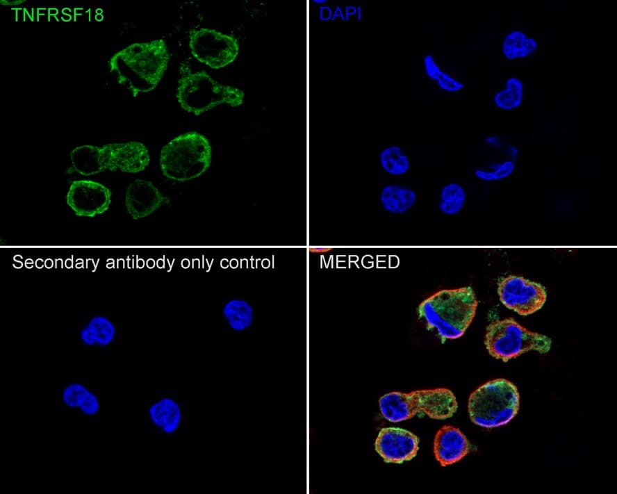 Immunocytochemistry/ Immunofluorescence: GITR/TNFRSF18 Antibody (PSH04-06) [NBP3-32382] - Immunocytochemistry analysis of HUT 102 cells labeling GITR/TNFRSF18 with Rabbit anti-GITR/TNFRSF18/TNFRSF18 antibody (NBP3-32382) at 1/200 dilution. Cells were fixed in 4% paraformaldehyde for 20 minutes at room temperature, permeabilized with 0.1% Triton X-100 in PBS for 5 minutes at room temperature, then blocked with 1% BSA in 10% negative goat serum for 1 hour at room temperature. Cells were then incubated with Rabbit anti-GITR/TNFRSF18 antibody (NBP3-32382) at 1/200 dilution in 1% BSA in PBST overnight at 4 ℃. Goat Anti-Rabbit IgG H&L (iFluor™ 488) was used as the secondary antibody at 1/1,000 dilution. PBS instead of the primary antibody was used as the secondary antibody only control. Nuclear DNA was labelled in blue with DAPI. Beta tubulin (red) was stained at 1/100 dilution overnight at +4℃. Goat Anti-Mouse IgG H&L (iFluor™ 594) was used as the secondary antibody at 1/1,000 dilution.