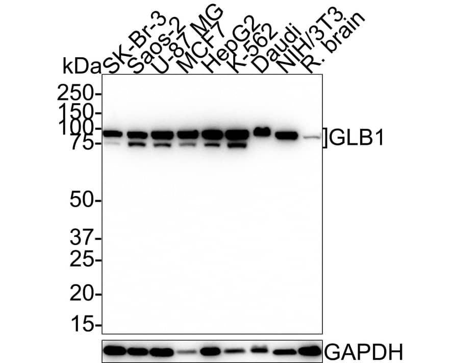 Western Blot: beta-Galactosidase-1/GLB1 Antibody (JE40-77) [NBP3-32383] - Western blot analysis of beta-Galactosidase-1/GLB1 on different lysates with Rabbit anti-beta-Galactosidase-1/GLB1 antibody (NBP3-32383) at 1/1,000 dilution. Lane 1: SK-Br-3 cell lysate (20 ug/Lane) Lane 2: Saos-2 cell lysate (20 ug/Lane) Lane 3: U-87 MG cell lysate (20 ug/Lane) Lane 4: MCF7 cell lysate (20 ug/Lane) Lane 5: HepG2 cell lysate (20 ug/Lane) Lane 6: K-562 cell lysate (20 ug/Lane) Lane 7: Daudi cell lysate (20 ug/Lane) Lane 8: NIH/3T3 cell lysate (20 ug/Lane) Lane 9: Rat brain tissue lysate (40 ug/Lane) Predicted band size: 76 kDa Observed band size: 76/100 kDa Exposure time: 3 minutes; 4-20% SDS-PAGE gel. Proteins were transferred to a PVDF membrane and blocked with 5% NFDM/TBST for 1 hour at room temperature. The primary antibody (NBP3-32383) at 1/1,000 dilution was used in 5% NFDM/TBST at 4  overnight. Goat Anti-Rabbit IgG - HRP Secondary Antibody at 1:100,000 dilution was used for 1 hour at room temperature.