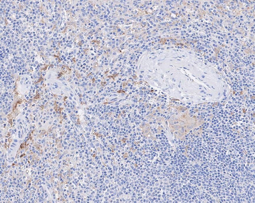 Immunohistochemistry: Glutamine Synthetase Antibody (A3G2-R) [NBP3-32387] - Immunohistochemical analysis of paraffin-embedded human spleen tissue with Mouse anti-Glutamine Synthetase antibody (NBP3-32387) at 1/500 dilution. The section was pre-treated using heat mediated antigen retrieval with Tris-EDTA buffer (pH 9.0) for 20 minutes. The tissues were blocked in 1% BSA for 20 minutes at room temperature, washed with ddH2O and PBS, and then probed with the primary antibody (NBP3-32387) at 1/500 dilution for 1 hour at room temperature. The detection was performed using an HRP conjugated compact polymer system. DAB was used as the chromogen. Tissues were counterstained with hematoxylin and mounted with DPX.