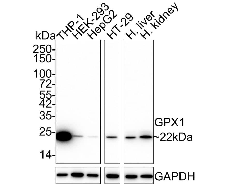 Western blot analysis on different lysates with NBP3-32388 at 1/1,000 dilution. Lane 1: THP-1 cell lysate (20 µg/Lane) Lane 2: HEK-293 cell lysate (20 µg/Lane) Lane 3: HepG2 cell lysate (20 µg/Lane) Lane 4: HT-29 cell lysate (20 µg/Lane) Lane 5: Human liver tissue lysate (40 µg/Lane) Lane 6: Human kidney tissue lysate (40 µg/Lane) Predicted band size: 22 kDa Observed band size: 22 kDa Exposure time: 3 minutes; 4-20% SDS-PAGE gel. Proteins were transferred to a PVDF membrane and blocked with 5% NFDM/TBST for 1 hour at room temperature. NBP3-32388 at 1/1,000 dilution was used in 5% NFDM/TBST at 4℃ overnight. Goat anti-Mouse IgG [HRP] at 1/50,000 dilution was used for 1 hour at room temperature.