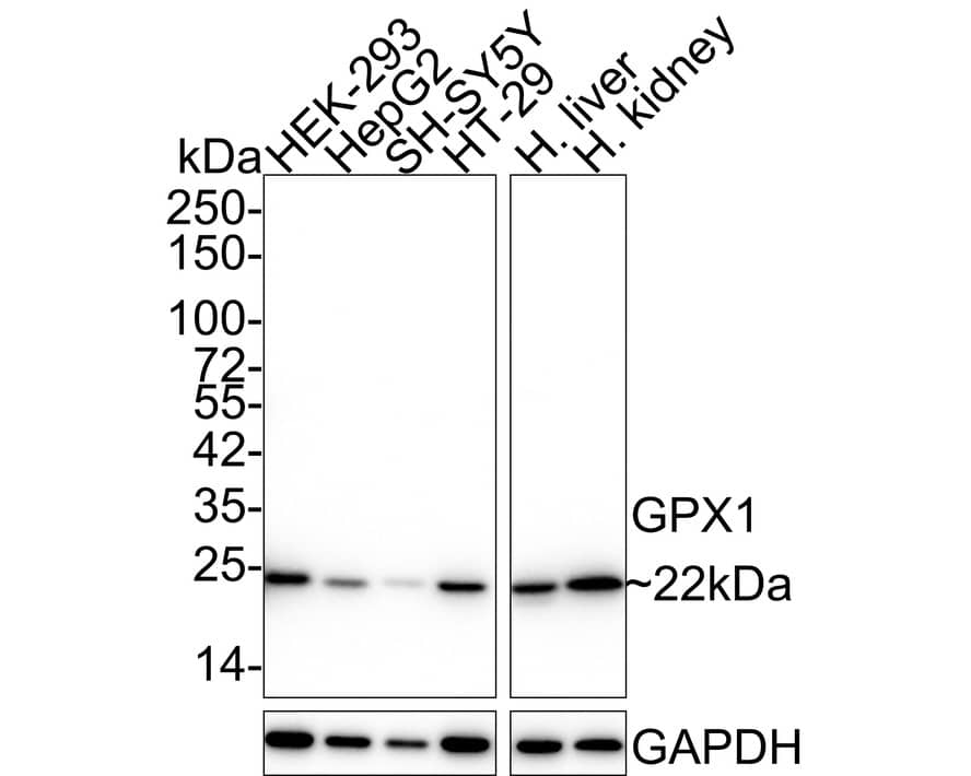 Western blot analysis on different lysates with NBP3-32389 at 1/1,000 dilution. Lane 1: HEK-293 cell lysate (20 µg/Lane) Lane 2: HepG2 cell lysate (20 µg/Lane) Lane 3: SH-SY5Y cell lysate (20 µg/Lane) Lane 4: HT-29 cell lysate (20 µg/Lane) Lane 5: Human liver tissue lysate (40 µg/Lane) Lane 6: Human kidney tissue lysate (40 µg/Lane) Predicted band size: 22 kDa Observed band size: 22 kDa Exposure time: 24 seconds; 4-20% SDS-PAGE gel. Proteins were transferred to a PVDF membrane and blocked with 5% NFDM/TBST for 1 hour at room temperature. NBP3-32389 at 1/1,000 dilution was used in 5% NFDM/TBST at 4℃ overnight. Goat anti-Mouse IgG [HRP] at 1/50,000 dilution was used for 1 hour at room temperature.