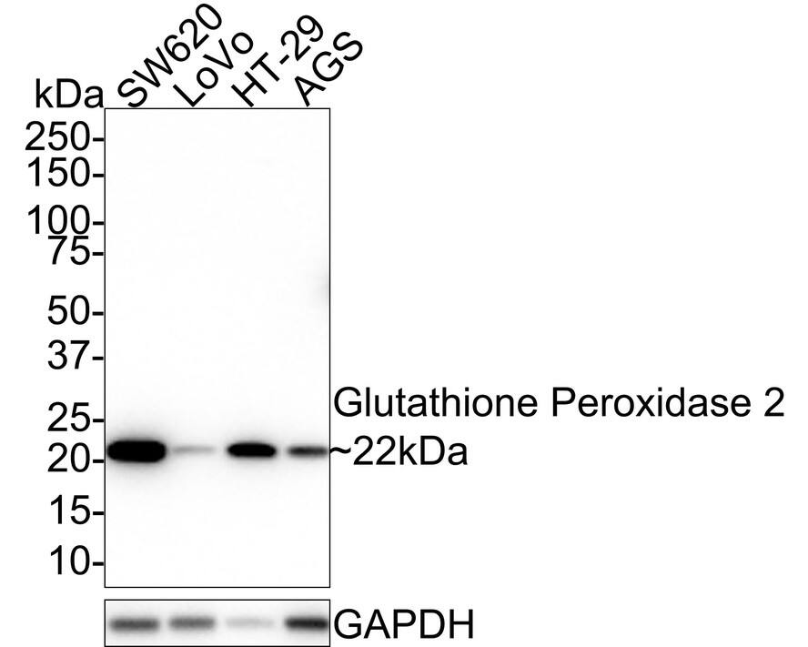 Western blot analysis on different lysates with NBP3-32390 at 1/1,000 dilution. Lane 1: SW620 cell lysate Lane 2: LoVo cell lysate Lane 3: HT-29 cell lysate Lane 4: AGS cell lysate Lysates/proteins at 20 µg/Lane. Predicted band size: 22 kDa Observed band size: 22 kDa Exposure time: 1 minute 17 seconds; 4-20% SDS-PAGE gel. Proteins were transferred to a PVDF membrane and blocked with 5% NFDM/TBST for 1 hour at room temperature. NBP3-32390 at 1/1,000 dilution was used in 5% NFDM/TBST at room temperature for 2 hours. Goat Anti-Rabbit IgG [HRP] Secondary Antibody at 1:100,000 dilution was used for 1 hour at room temperature.