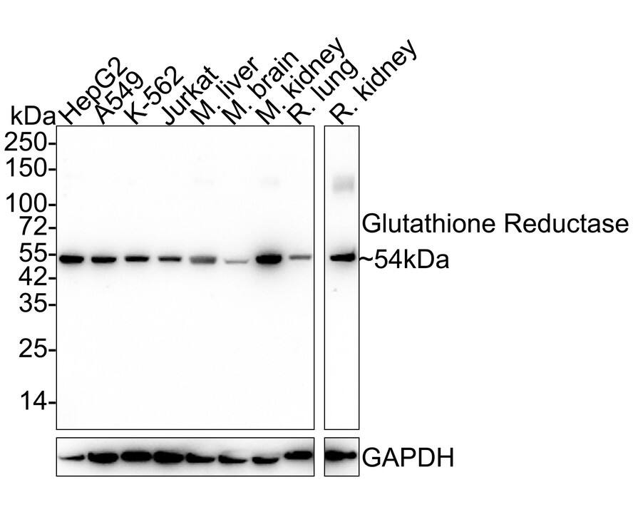 Western blot analysis on different lysates with NBP3-32391 at 1/2,000 dilution. Lane 1: HepG2 cell lysate (20 µg/Lane) Lane 2: A549 cell lysate (20 µg/Lane) Lane 3: K-562 cell lysate (20 µg/Lane) Lane 4: Jurkat cell lysate (20 µg/Lane) Lane 5: Mouse liver tissue lysate (40 µg/Lane) Lane 6: Mouse brain tissue lysate (40 µg/Lane) Lane 7: Mouse kidney tissue lysate (40 µg/Lane) Lane 8: Rat lung tissue lysate (40 µg/Lane) Lane 9: Rat kidney tissue lysate (40 µg/Lane) Predicted band size: 56 kDa Observed band size: 54 kDa Exposure time: 10 seconds;  4-20% SDS-PAGE gel. Proteins were transferred to a PVDF membrane and blocked with 5% NFDM/TBST for 1 hour at room temperature. NBP3-32391 at 1/2,000 dilution was used in 5% NFDM/TBST at 4℃ overnight. Goat Anti-Rabbit IgG [HRP] Secondary Antibody at 1/50,000 dilution was used for 1 hour at room temperature.