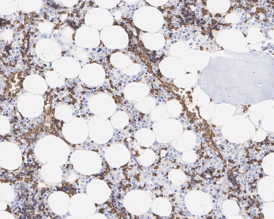 Immunohistochemistry: Glycophorin A Antibody (JE32-24) [NBP3-32393] - Immunohistochemical analysis of paraffin-embedded human bone marrow tissue with Rabbit anti-Glycophorin A antibody (NBP3-32393) at 1/1,000 dilution. The section was pre-treated using heat mediated antigen retrieval with Tris-EDTA buffer (pH 9.0) for 20 minutes. The tissues were blocked in 1% BSA for 20 minutes at room temperature, washed with ddH2O and PBS, and then probed with the primary antibody (NBP3-32393) at 1/1,000 dilution for 1 hour at room temperature. The detection was performed using an HRP conjugated compact polymer system. DAB was used as the chromogen. Tissues were counterstained with hematoxylin and mounted with DPX.