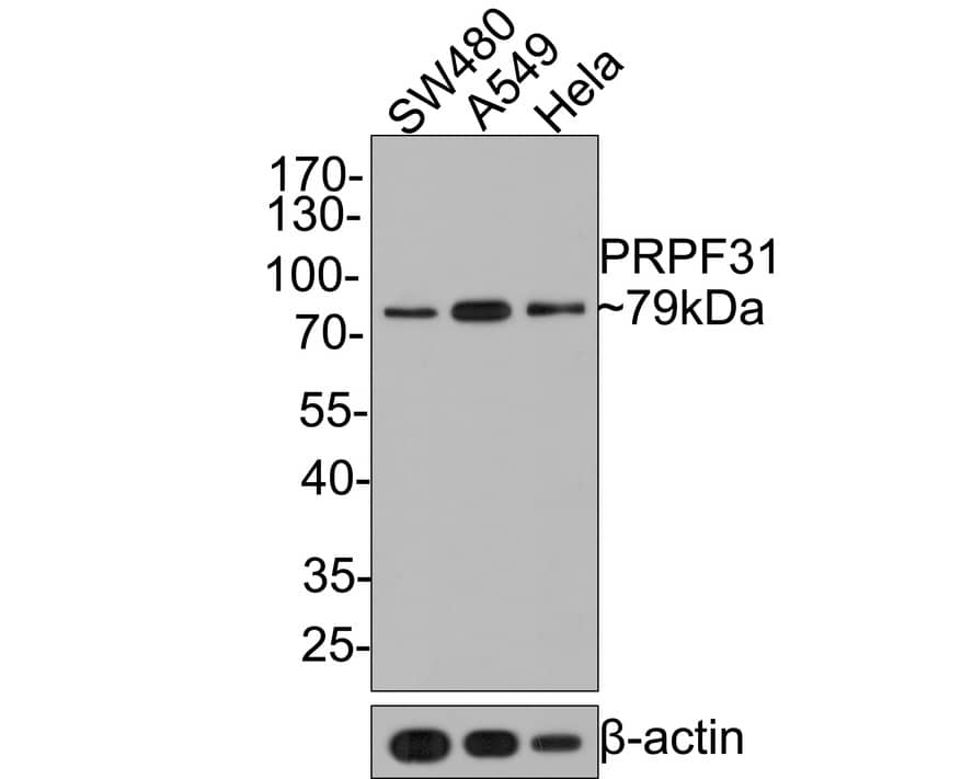 Western Blot: N-Acetylmannosamine Kinase/GNE Antibody (JE64-81) [NBP3-32397] - Western blot analysis of N-Acetylmannosamine Kinase/GNE on different lysates with Rabbit anti-N-Acetylmannosamine Kinase/GNE antibody (NBP3-32397) at 1/500 dilution. Lane 1: SW480 cell lysate Lane 2: A549 cell lysate Lane 3: Hela cell lysate Lysates/proteins at 10 ug/Lane. Predicted band size: 79 kDa Observed band size: 79 kDa Exposure time: 2 minutes; 10% SDS-PAGE gel. Proteins were transferred to a PVDF membrane and blocked with 5% NFDM/TBST for 1 hour at room temperature. The primary antibody (NBP3-32397) at 1/500 dilution was used in 5% NFDM/TBST at room temperature for 2 hours. Goat Anti-Rabbit IgG - HRP Secondary Antibody at 1:300,000 dilution was used for 1 hour at room temperature.