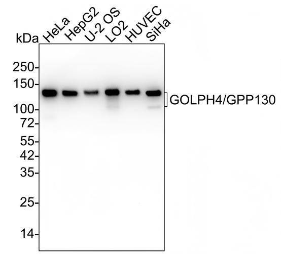 Western blot analysis on different lysates with NBP3-32399 at 1/5,000 dilution and competitor's antibody at 1/1,000 dilution. Lane 1: HeLa cell lysate Lane 2: HepG2 cell lysate Lane 3: U-2 OS cell lysate Lane 4: LO2 cell lysate Lane 5: HUVEC cell lysate Lane 6: SiHa cell lysate Lysates/proteins at 15 µg/Lane. Predicted band size: 82 kDa Observed band size: 130/82 kDa Exposure time: Lane 1-6 (left): 1 minute 2 seconds; Lane 1-6 (right): 3 minutes;  4-20% SDS-PAGE gel. Proteins were transferred to a PVDF membrane and blocked with 5% NFDM/TBST for 1 hour at room temperature. NBP3-32399 at 1/5,000 dilution and competitor's antibody at 1/1,000 dilution were used in 5% NFDM/TBST at 4℃ overnight. Goat Anti-Rabbit IgG [HRP] Secondary Antibody at 1/50,000 dilution was used for 1 hour at room temperature.
