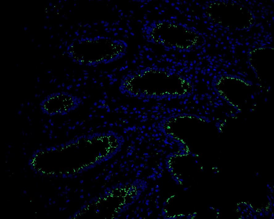 Immunohistochemistry: GOLPH4 Antibody (PSH02-98) [NBP3-32399] - Immunofluorescence analysis of paraffin-embedded human colon tissue labeling GOLPH4 with Rabbit anti-GOLPH4 antibody (NBP3-32399) at 1/200 dilution. The section was pre-treated using heat mediated antigen retrieval with Tris-EDTA buffer (pH 9.0) for 20 minutes. The tissues were blocked in 10% negative goat serum for 1 hour at room temperature, washed with PBS, and then probed with the primary antibody (NBP3-32399, green) at 1/200 dilution overnight at 4 ℃, washed with PBS. Goat Anti-Rabbit IgG H&L (iFluor™ 488) was used as the secondary antibody at 1/1,000 dilution. Nuclei were counterstained with DAPI (blue).