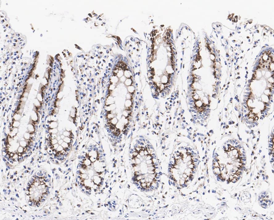 Immunohistochemistry GOLPH4 Antibody (PSH02-98)