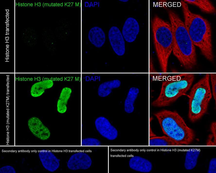 Immunocytochemistry/ Immunofluorescence: Histone H3 Antibody (JE46-51) - K27M mutant [NBP3-32401] - Immunocytochemistry analysis of HeLa cells transfacted with Histone H3 / Histone H3 labeling Histone H3 (K27M mutant ) with Rabbit anti-Histone H3 antibody (NBP3-32401) at 1/1,000 dilution. Cells were fixed in 4% paraformaldehyde for 20 minutes at room temperature, permeabilized with 0.1% Triton X-100 in PBS for 5 minutes at room temperature, then blocked with 1% BSA in 10% negative goat serum for 1 hour at room temperature. Cells were then incubated with Rabbit anti-Histone H3 antibody (NBP3-32401) at 1/1,000 dilution in 1% BSA in PBST overnight at 4 ℃. Goat Anti-Rabbit IgG H&L (iFluor™ 488) was used as the secondary antibody at 1/1,000 dilution. PBS instead of the primary antibody was used as the secondary antibody only control. Nuclear DNA was labelled in blue with DAPI. Beta tubulin (red) was stained at 1/100 dilution overnight at +4℃. Goat Anti-Mouse IgG H&L (iFluor™ 594) was used as the secondary antibody at 1/1,000 dilution.