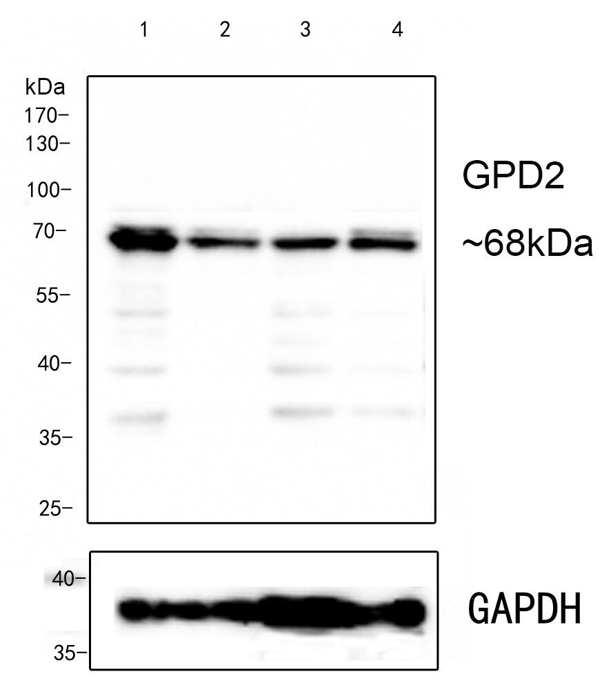 Western blot analysis on different lysates with NBP3-32402 at 1/1,000 dilution. Lane 1: MCF-7 cell lysate Lane 2: THP-1 cell lysate Lane 3: U87-MG cell lysate Lane 4: HeLa cell lysate Lysates/proteins at 10 µg/Lane. Predicted band size: 81 kDa Observed band size: 68 kDa Exposure time: 10s; 10% SDS-PAGE gel. Proteins were transferred to a PVDF membrane and blocked with 5% NFDM/TBST for 1 hour at room temperature. NBP3-32402 at 1/1,000 dilution was used in 5% NFDM/TBST at room temperature for 2 hours. Goat Anti-Rabbit IgG [HRP] Secondary Antibody at 1:200,000 dilution was used for 1 hour at room temperature.