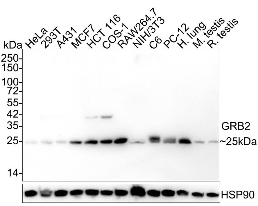 Western blot analysis on different lysates with NBP3-32403 at 1/2,000 dilution. Lane 1: HeLa cell lysate Lane 2: 293T cell lysate Lane 3: A431 cell lysate Lane 4: MCF7 cell lysate Lane 5: HCT 116 cell lysate Lane 6: COS-1 cell lysate Lane 7: RAW264.7 cell lysate Lane 8: NIH/3T3 cell lysate Lane 9: C6 cell lysate Lane 10: PC-12 cell lysate Lane 11: Human lung tissue lysate Lane 12: Mouse testis tissue lysate Lane 13: Rat testis tissue lysate Lysates/proteins at 30 µg/Lane. Predicted band size: 25 kDa Observed band size: 25 kDa Exposure time: 3 minutes; 4-20% SDS-PAGE gel. Proteins were transferred to a PVDF membrane and blocked with 5% NFDM/TBST for 1 hour at room temperature. NBP3-32403 at 1/2,000 dilution was used in 5% NFDM/TBST at 4℃ overnight. Goat Anti-Rabbit IgG [HRP] Secondary Antibody at 1/50,000 dilution was used for 1 hour at room temperature.