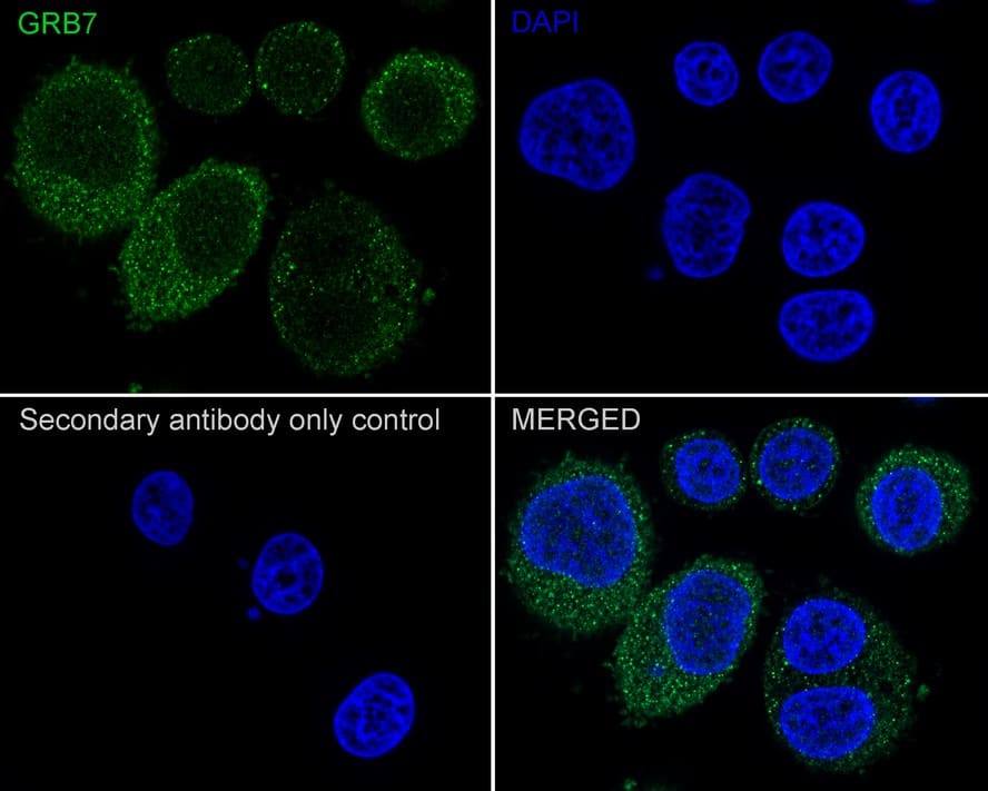 Immunocytochemistry/ Immunofluorescence: GRB7 Antibody (JE50-05) [NBP3-32404] - Immunocytochemistry analysis of SK-Br-3 cells labeling GRB7 with Rabbit anti-GRB7 antibody (NBP3-32404) at 1/100 dilution. Cells were fixed in 4% paraformaldehyde for 20 minutes at room temperature, permeabilized with 0.1% Triton X-100 in PBS for 5 minutes at room temperature, then blocked with 1% BSA in 10% negative goat serum for 1 hour at room temperature. Cells were then incubated with Rabbit anti-GRB7 antibody (NBP3-32404) at 1/100 dilution in 1% BSA in PBST overnight at 4 ℃. Goat Anti-Rabbit IgG H&L (iFluor™ 488) was used as the secondary antibody at 1/1,000 dilution. PBS instead of the primary antibody was used as the secondary antibody only control. Nuclear DNA was labelled in blue with DAPI.