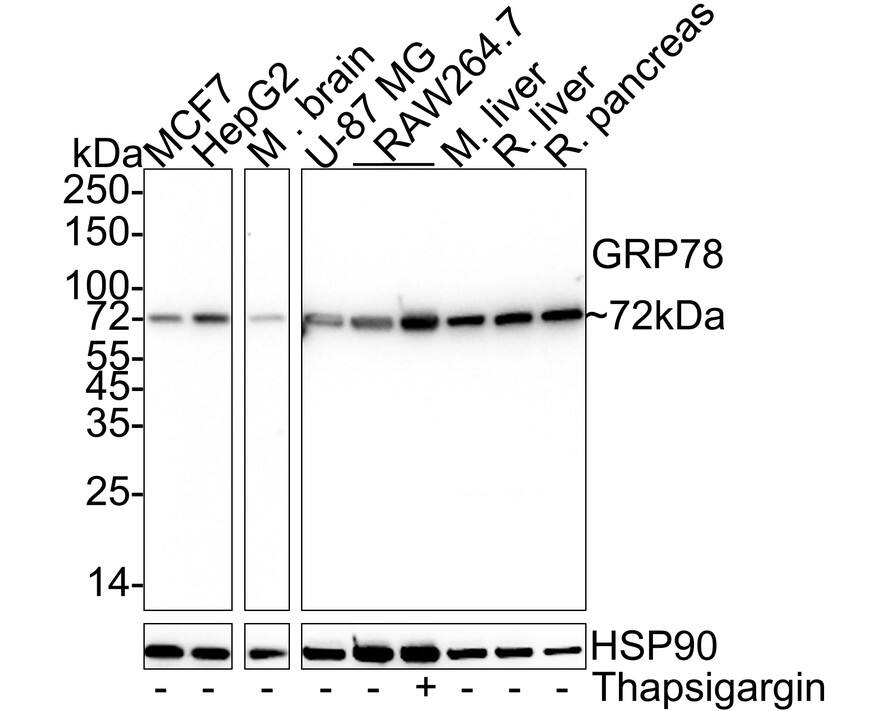 Western blot analysis on different lysates with NBP3-32408 at 1/1,000 dilution. Lane 1: MCF7 cell lysate (15 µg/Lane) Lane 2: HepG2 cell lysate (15 µg/Lane) Lane 3: Mouse brain tissue lysate (30 µg/Lane) Lane 4: U-87 MG cell lysate (30 µg/Lane) Lane 5: RAW264.7 cell lysate (30 µg/Lane) Lane 6: RAW264.7 treated with 300nM Thapsigargin for 18 hours cell lysate (30 µg/Lane) Lane 7: Mouse liver tissue lysate (30 µg/Lane) Lane 8: Rat liver tissue lysate (30 µg/Lane) Lane 9: Rat pancreas tissue lysate (30 µg/Lane) Predicted band size: 72 kDa Observed band size: 72 kDa Exposure time: Lane 1-3: 11 seconds; Lane 4-9: 4 seconds;  4-20% SDS-PAGE gel. Proteins were transferred to a PVDF membrane and blocked with 5% NFDM/TBST for 1 hour at room temperature. NBP3-32408 at 1/1,000 dilution was used in 5% NFDM/TBST at 4℃ overnight. Goat anti-Mouse IgG [HRP] at 1/50,000 dilution was used for 1 hour at room temperature.