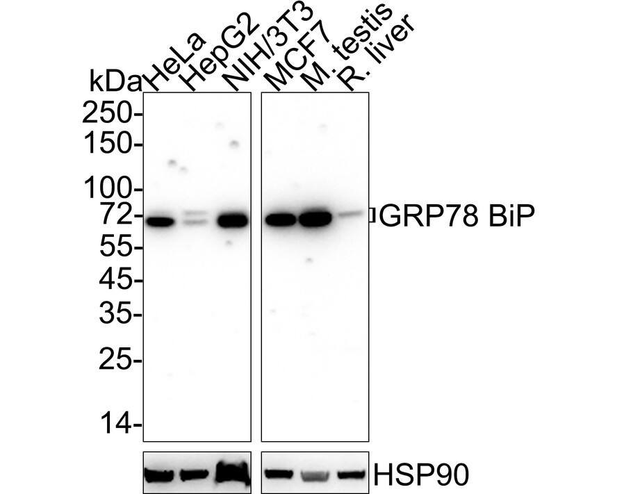 Western blot analysis on different lysates with NBP3-32409 at 1/2,000 dilution. Lane 1: HeLa cell lysate (20 µg/Lane) Lane 2: HepG2 cell lysate (20 µg/Lane) Lane 3: NIH/3T3 cell lysate (20 µg/Lane) Lane 4: MCF7 cell lysate (20 µg/Lane) Lane 5: Mouse testis tissue lysate (40 µg/Lane) Lane 6: Rat liver tissue lysate (40 µg/Lane) Predicted band size: 72 kDa Observed band size: 70/72 kDa Exposure time: 1 minute 2 seconds; 4-20% SDS-PAGE gel. Proteins were transferred to a PVDF membrane and blocked with 5% NFDM/TBST for 1 hour at room temperature. NBP3-32409 at 1/2,000 dilution was used in 5% NFDM/TBST at 4℃ overnight. Goat anti-Mouse IgG [HRP] at 1/50,000 dilution was used for 1 hour at room temperature.
