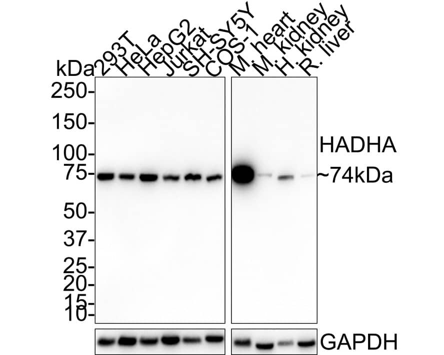 Western blot analysis on different lysates with NBP3-32414 at 1/1,000 dilution. Lane 1: 293T cell lysate Lane 2: HeLa cell lysate Lane 3: HepG2 cell lysate Lane 4: Jurkat cell lysate Lane 5: SH-SY5Y cell lysate Lane 6: COS-1 cell lysate Lane 7: Mouse heart tissue lysate Lane 8: Mouse kidney tissue lysate Lane 9: Human kidney tissue lysate Lane 10: Rat liver tissue lysate Lysates/proteins at 30 µg/Lane. Predicted band size: 83 kDa Observed band size: 74 kDa Exposure time: 1 minute 40 seconds; 4-20% SDS-PAGE gel. Proteins were transferred to a PVDF membrane and blocked with 5% NFDM/TBST for 1 hour at room temperature. NBP3-32414 at 1/1,000 dilution was used in 5% NFDM/TBST at room temperature for 2 hours. Goat Anti-Rabbit IgG [HRP] Secondary Antibody at 1:100,000 dilution was used for 1 hour at room temperature.