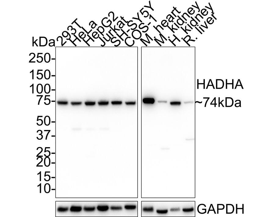 Western blot analysis on different lysates with NBP3-32415 at 1/1,000 dilution. Lane 1: 293T cell lysate Lane 2: HeLa cell lysate Lane 3: HepG2 cell lysate Lane 4: Jurkat cell lysate Lane 5: SH-SY5Y cell lysate Lane 6: COS-1 cell lysate Lane 7: Mouse heart tissue lysate Lane 8: Mouse kidney tissue lysate Lane 9: Human kidney tissue lysate Lane 10: Rat liver tissue lysate Lysates/proteins at 30 µg/Lane. Predicted band size: 83 kDa Observed band size: 74 kDa Exposure time: 24 seconds; 4-20% SDS-PAGE gel. Proteins were transferred to a PVDF membrane and blocked with 5% NFDM/TBST for 1 hour at room temperature. NBP3-32415 at 1/1,000 dilution was used in 5% NFDM/TBST at room temperature for 2 hours. Goat Anti-Rabbit IgG [HRP] Secondary Antibody at 1:100,000 dilution was used for 1 hour at room temperature.