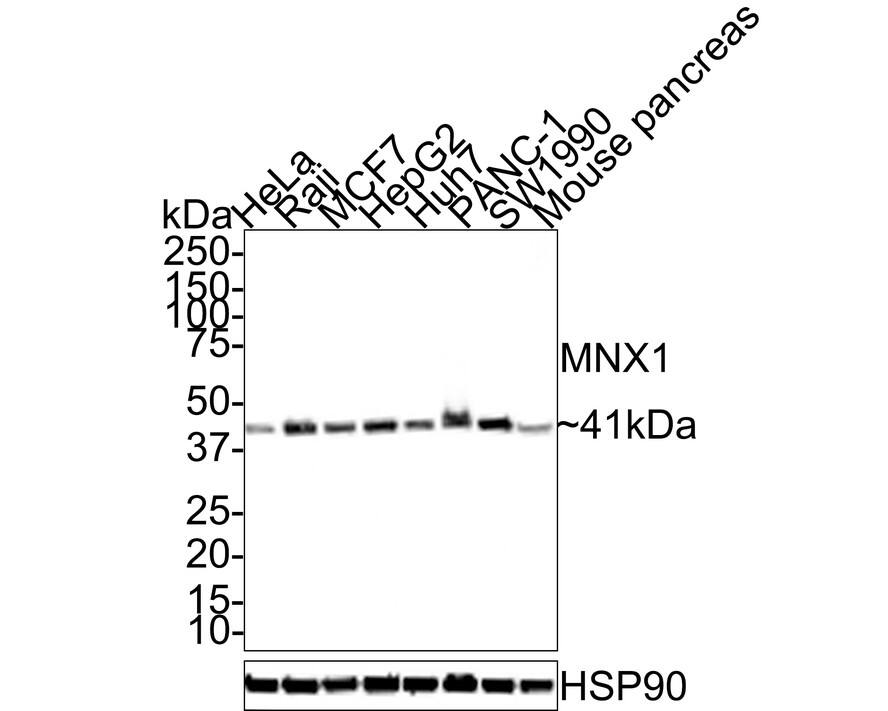 Western Blot: MNX1/HLXB9 Antibody (JE32-08) [NBP3-32417] - Western blot analysis of MNX1/HLXB9 on different lysates with Rabbit anti-MNX1/HLXB9 antibody (NBP3-32417) at 1/1,000 dilution. Lane 1: HeLa cell lysate (15 ug/Lane) Lane 2: Raji cell lysate (15 ug/Lane) Lane 3: MCF7 cell lysate (15 ug/Lane) Lane 4: HepG2 cell lysate (15 ug/Lane) Lane 5: Huh7 cell lysate (15 ug/Lane) Lane 6: PANC-1 cell lysate (15 ug/Lane) Lane 7: SW1990 cell lysate (15 ug/Lane) Lane 8: Mouse pancreas tissue lysate (30 ug/Lane) Predicted band size: 41 kDa Observed band size: 41 kDa Exposure time: 5 seconds; 4-20% SDS-PAGE gel. Proteins were transferred to a PVDF membrane and blocked with 5% NFDM/TBST for 1 hour at room temperature. The primary antibody (NBP3-32417) at 1/1,000 dilution was used in 5% NFDM/TBST at room temperature for 2 hours. Goat Anti-Rabbit IgG - HRP Secondary Antibody at 1:100,000 dilution was used for 1 hour at room temperature.