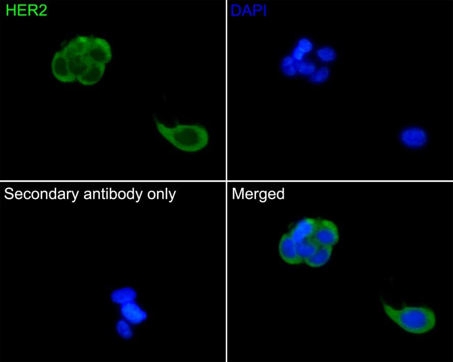 Immunocytochemistry/ Immunofluorescence: ErbB2/Her2 Antibody (PD00-53) [NBP3-32422] - Immunocytochemistry analysis of MCF-7 cells labeling ErbB2/Her2 with Rabbit anti-ErbB2/Her2 antibody (NBP3-32422) at 1/50 dilution. Cells were fixed in 4% paraformaldehyde for 10 minutes at 37 ℃, permeabilized with 0.05% Triton X-100 in PBS for 20 minutes, and then blocked with 2% negative goat serum for 30 minutes at room temperature. Cells were then incubated with Rabbit anti-ErbB2/Her2 antibody (NBP3-32422) at 1/50 dilution in 2% negative goat serum overnight at 4 ℃. Goat Anti-Rabbit IgG H&L (iFluor™ 488) was used as the secondary antibody at 1/1,000 dilution. PBS instead of the primary antibody was used as the secondary antibody only control. Nuclear DNA was labelled in blue with DAPI.