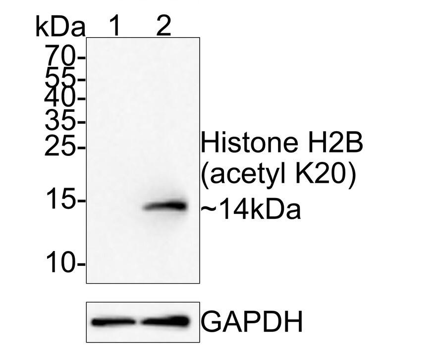 Western blot analysis on different lysates with NBP3-32427 at 1/1,000 dilution. Lane 1: Hela whole cell lysate (20 µg/Lane) Lane 2: Hela treated with 500 ng/ml TSA for 4 hours whole cell lysate (20 µg/Lane) Predicted band size: 14 kDa Observed band size: 14 kDa Exposure time: 2 minutes; 15% SDS-PAGE gel. Proteins were transferred to a PVDF membrane and blocked with 5% NFDM/TBST for 1 hour at room temperature. NBP3-32427 at 1/1,000 dilution was used in 5% NFDM/TBST at room temperature for 2 hours. Goat Anti-Rabbit IgG [HRP] Secondary Antibody at 1/300,000 dilution was used for 1 hour at room temperature.