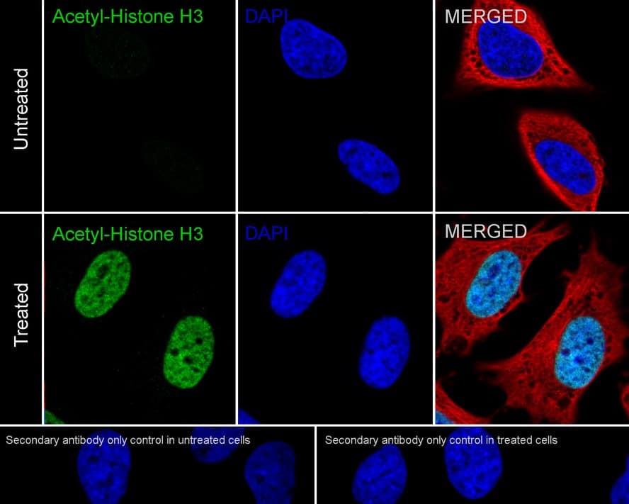 Immunocytochemistry/ Immunofluorescence: Histone H3 [ac Lys4] Antibody (PSH03-71) [NBP3-32429] - Immunocytochemistry analysis of HeLa cells treated with or without 500ng/mL TSA for 4 hours labeling Histone H3 with Rabbit anti-Histone H3 antibody (NBP3-32429) at 1/500 dilution. Cells were fixed in 4% paraformaldehyde for 20 minutes at room temperature, permeabilized with 0.1% Triton X-100 in PBS for 5 minutes at room temperature, then blocked with 1% BSA in 10% negative goat serum for 1 hour at room temperature. Cells were then incubated with Rabbit anti-Histone H3 antibody (NBP3-32429) at 1/500 dilution in 1% BSA in PBST overnight at 4 ℃. Goat Anti-Rabbit IgG H&L (iFluor™ 488) was used as the secondary antibody at 1/1,000 dilution. PBS instead of the primary antibody was used as the secondary antibody only control. Nuclear DNA was labelled in blue with DAPI. Beta tubulin (red) was stained at 1/100 dilution overnight at +4℃. Goat Anti-Mouse IgG H&L (iFluor™ 594) was used as the secondary antibody at 1/1,000 dilution.