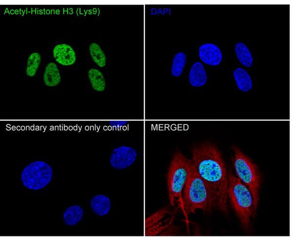 Immunocytochemistry/ Immunofluorescence: Histone H3 [ac Lys9] Antibody (PSH04-47) [NBP3-32430] - Immunocytochemistry analysis of C6 cells labeling Histone H3 with Rabbit anti-Histone H3 antibody (NBP3-32430) at 1/10,000 dilution. Cells were fixed in 4% paraformaldehyde for 20 minutes at room temperature, permeabilized with 0.1% Triton X-100 in PBS for 5 minutes at room temperature, then blocked with 1% BSA in 10% negative goat serum for 1 hour at room temperature. Cells were then incubated with Rabbit anti-Histone H3 antibody at 1/10,000 dilution in 1% BSA in PBST overnight at 4 ℃. Goat Anti-Rabbit IgG H&L (iFluor™ 488) was used as the secondary antibody at 1/1,000 dilution. PBS instead of the primary antibody was used as the secondary antibody only control. Nuclear DNA was labelled in blue with DAPI. Beta tubulin (red) was stained at 1/100 dilution overnight at +4℃. Goat Anti-Mouse IgG H&L (iFluor™ 594) was used as the secondary antibody at 1/1,000 dilution.