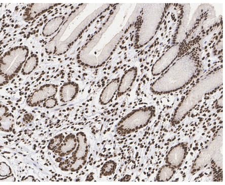 Immunohistochemistry: Histone H3 [ac Lys9] Antibody (PSH04-47) [NBP3-32430] - Immunohistochemical analysis of paraffin-embedded human stomach tissue with Rabbit anti-Histone H3 antibody (NBP3-32430) at 1/2,000 dilution. The section was pre-treated using heat mediated antigen retrieval with sodium citrate buffer (pH 6.0) for 2 minutes. The tissues were blocked in 1% BSA for 20 minutes at room temperature, washed with ddH2O and PBS, and then probed with the primary antibody at 1/2,000 dilution for 1 hour at room temperature. The detection was performed using an HRP conjugated compact polymer system. DAB was used as the chromogen. Tissues were counterstained with hematoxylin and mounted with DPX.