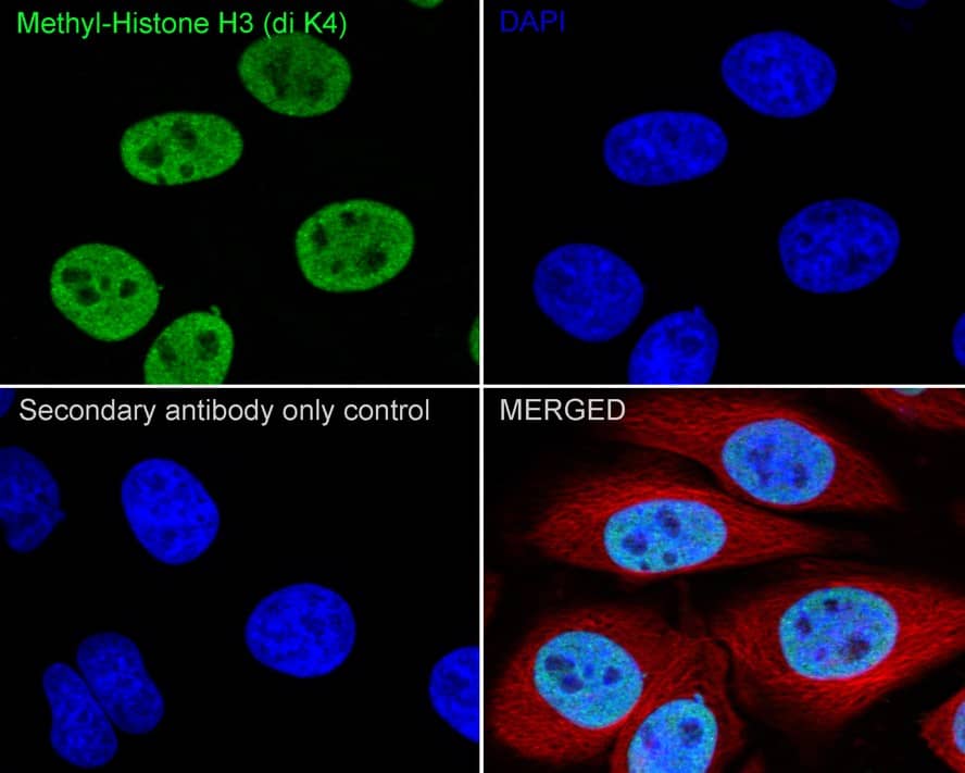 Immunocytochemistry/ Immunofluorescence: Histone H3 [Dimethyl Lys4] Antibody (JE00-98) [NBP3-32431] - Immunocytochemistry analysis of HeLa cells labeling Histone H3 with Rabbit anti-Histone H3 antibody (NBP3-32431) at 1/500 dilution. Cells were fixed in 4% paraformaldehyde for 20 minutes at room temperature, permeabilized with 0.1% Triton X-100 in PBS for 5 minutes at room temperature, then blocked with 1% BSA in 10% negative goat serum for 1 hour at room temperature. Cells were then incubated with Rabbit anti-Histone H3 antibody (NBP3-32431) at 1/500 dilution in 1% BSA in PBST overnight at 4 ℃. Goat Anti-Rabbit IgG H&L (iFluor™ 488) was used as the secondary antibody at 1/1,000 dilution. PBS instead of the primary antibody was used as the secondary antibody only control. Nuclear DNA was labelled in blue with DAPI. Beta tubulin (red) was stained at 1/100 dilution overnight at +4℃. Goat Anti-Mouse IgG H&L (iFluor™ 594) was used as the secondary antibody at 1/1,000 dilution.