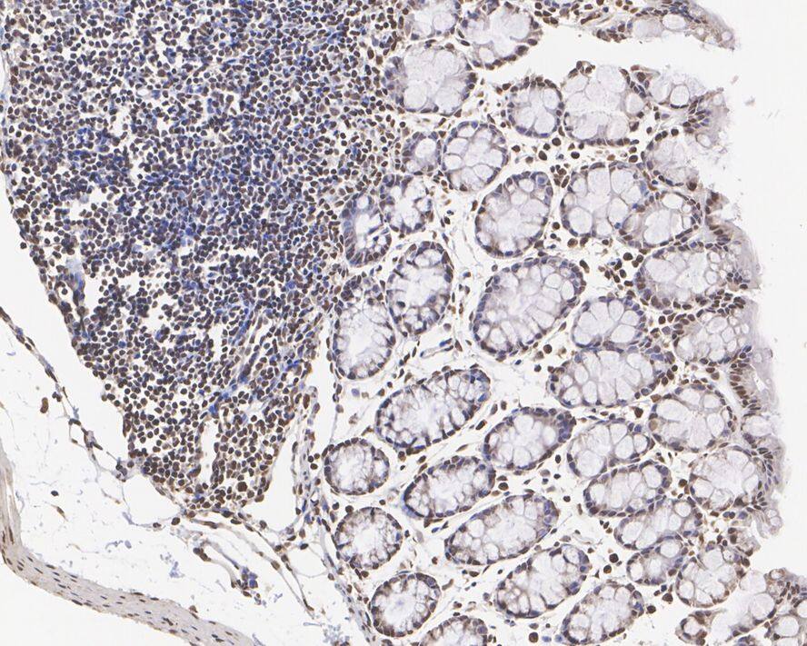 Immunohistochemistry: Histone H3 [Dimethyl Lys4] Antibody (JE00-98) [NBP3-32431] - Immunohistochemical analysis of paraffin-embedded mouse colon tissue with Rabbit anti-Histone H3 antibody (NBP3-32431) at 1/10,000 dilution. The section was pre-treated using heat mediated antigen retrieval with sodium citrate buffer (pH 6.0) for 2 minutes. The tissues were blocked in 1% BSA for 20 minutes at room temperature, washed with ddH2O and PBS, and then probed with the primary antibody (NBP3-32431) at 1/10,000 dilution for 1 hour at room temperature. The detection was performed using an HRP conjugated compact polymer system. DAB was used as the chromogen. Tissues were counterstained with hematoxylin and mounted with DPX.