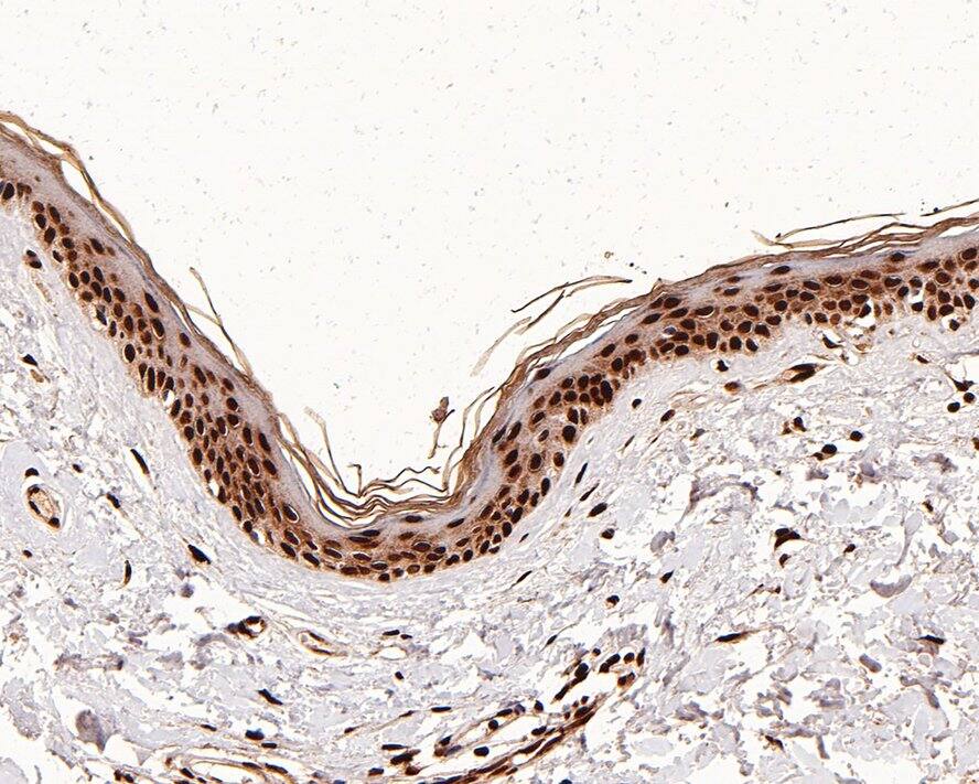 Immunohistochemistry: Histone H4 [ac Lys8] Antibody (PS01-25) [NBP3-32432] - Immunohistochemical analysis of paraffin-embedded human skin tissue with Rabbit anti-Histone H4 antibody (NBP3-32432) at 1/1,000 dilution. The section was pre-treated using heat mediated antigen retrieval with sodium citrate buffer (pH 6.0) for 2 minutes. The tissues were blocked in 1% BSA for 20 minutes at room temperature, washed with ddH2O and PBS, and then probed with the primary antibody (NBP3-32432) at 1/1,000 dilution for 1 hour at room temperature. The detection was performed using an HRP conjugated compact polymer system. DAB was used as the chromogen. Tissues were counterstained with hematoxylin and mounted with DPX.