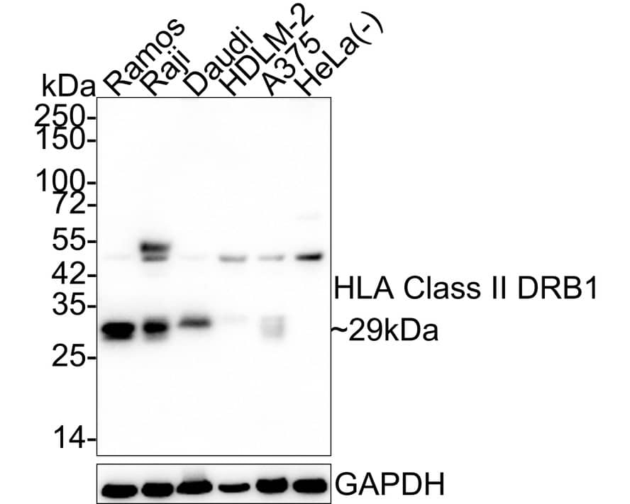 Western blot analysis on different lysates with NBP3-32433 at 1/1,000 dilution. Lane 1: Ramos cell lysate Lane 2: Raji cell lysate Lane 3: Daudi cell lysate Lane 4: HDLM-2 cell lysate Lane 5: A375 cell lysate Lane 6: HeLa cell lysate (negative) Lysates/proteins at 20 µg/Lane. Predicted band size: 29 kDa Observed band size: 29 kDa Exposure time: 1 minute; 4-20% SDS-PAGE gel. Proteins were transferred to a PVDF membrane and blocked with 5% NFDM/TBST for 1 hour at room temperature. NBP3-32433 at 1/1,000 dilution was used in 5% NFDM/TBST at 4℃ overnight. Goat Anti-Rabbit IgG [HRP] Secondary Antibody at 1/50,000 dilution was used for 1 hour at room temperature.