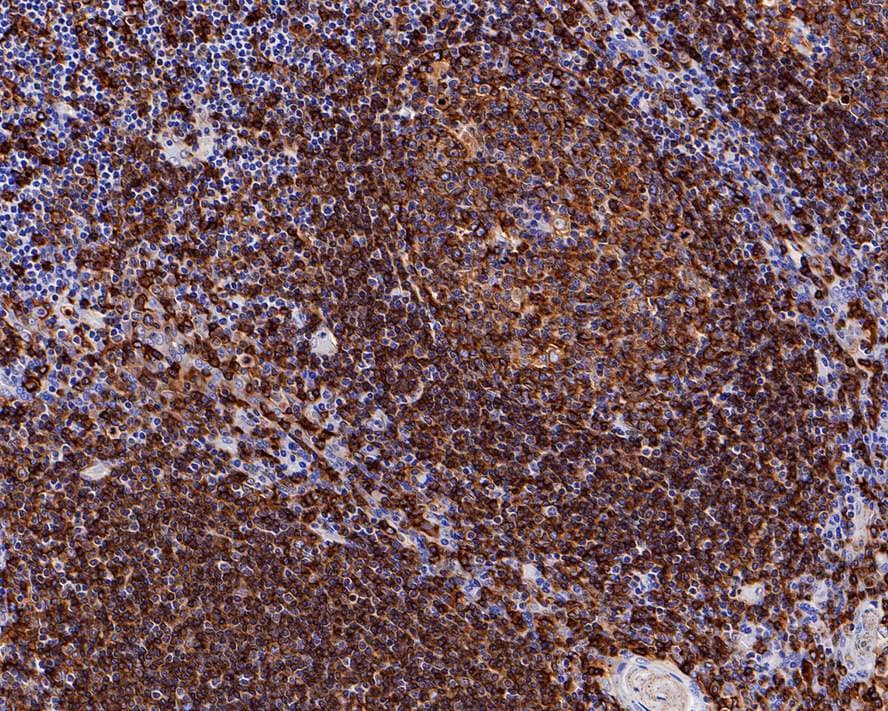 Immunohistochemistry: HLA DP Antibody (PD00-70) [NBP3-32434] - Immunohistochemical analysis of paraffin-embedded human tonsil tissue with Rabbit anti-HLA DP antibody (NBP3-32434) at 1/200 dilution. The section was pre-treated using heat mediated antigen retrieval with Tris-EDTA buffer (pH 9.0) for 20 minutes. The tissues were blocked in 1% BSA for 20 minutes at room temperature, washed with ddH2O and PBS, and then probed with the primary antibody (NBP3-32434) at 1/200 dilution for 1 hour at room temperature. The detection was performed using an HRP conjugated compact polymer system. DAB was used as the chromogen. Tissues were counterstained with hematoxylin and mounted with DPX.