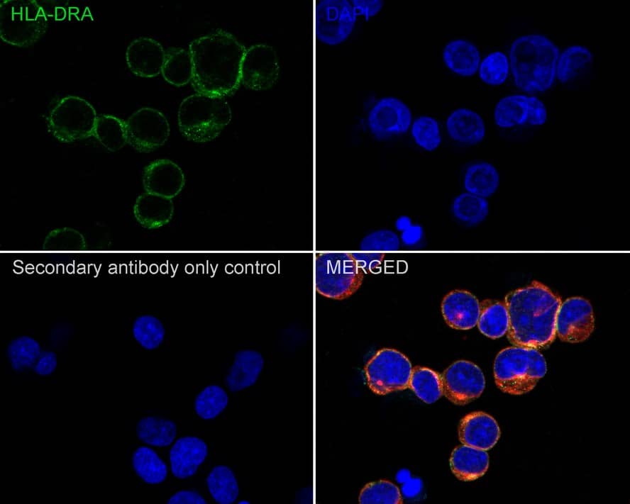 Immunocytochemistry/ Immunofluorescence: HLA-DR Antibody (10-D8-R) [NBP3-32435] - Immunocytochemistry analysis of Daudi cells labeling HLA-DR with Mouse anti-HLA-DR antibody (NBP3-32435) at 1/100 dilution. Cells were fixed in 4% paraformaldehyde for 20 minutes at room temperature, permeabilized with 0.1% Triton X-100 in PBS for 5 minutes at room temperature, then blocked with 1% BSA in 10% negative goat serum for 1 hour at room temperature. Cells were then incubated with Mouse anti-HLA-DR antibody (NBP3-32435) at 1/100 dilution in 1% BSA in PBST overnight at 4 ℃. Goat Anti-Mouse IgG H&L (iFluor™ 488) was used as the secondary antibody at 1/1,000 dilution. PBS instead of the primary antibody was used as the secondary antibody only control. Nuclear DNA was labelled in blue with DAPI. beta Tubulin (red) was stained at 1/100 dilution overnight at +4℃. Goat Anti-Rabbit IgG H&L (iFluor™ 594) were used as the secondary antibody at 1/1,000 dilution.