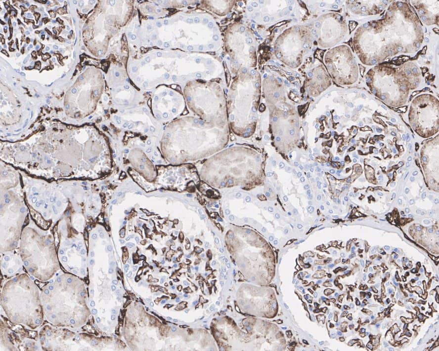 Immunohistochemistry: HLA-DR Antibody (10-D8-R) [NBP3-32435] - Immunohistochemical analysis of paraffin-embedded human kidney tissue with Mouse anti-HLA-DR antibody (NBP3-32435) at 1/1,000 dilution. The section was pre-treated using heat mediated antigen retrieval with Tris-EDTA buffer (pH 9.0) for 20 minutes. The tissues were blocked in 1% BSA for 20 minutes at room temperature, washed with ddH2O and PBS, and then probed with the primary antibody (NBP3-32435) at 1/1,000 dilution for 1 hour at room temperature. The detection was performed using an HRP conjugated compact polymer system. DAB was used as the chromogen. Tissues were counterstained with hematoxylin and mounted with DPX.