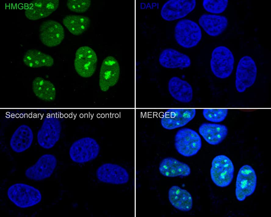 Immunocytochemistry/ Immunofluorescence: HMGB2 Antibody (JE52-82) [NBP3-32436] - Immunocytochemistry analysis of MCF7 cells labeling HMGB2 with Rabbit anti-HMGB2 antibody (NBP3-32436) at 1/200 dilution. Cells were fixed in 4% paraformaldehyde for 20 minutes at room temperature, permeabilized with 0.1% Triton X-100 in PBS for 5 minutes at room temperature, then blocked with 1% BSA in 10% negative goat serum for 1 hour at room temperature. Cells were then incubated with Rabbit anti-HMGB2 antibody (NBP3-32436) at 1/200 dilution in 1% BSA in PBST overnight at 4 ℃. Goat Anti-Rabbit IgG H&L (iFluor™ 488) was used as the secondary antibody at 1/1,000 dilution. PBS instead of the primary antibody was used as the secondary antibody only control. Nuclear DNA was labelled in blue with DAPI. Beta tubulin (red) was stained at 1/100 dilution overnight at +4℃. Goat Anti-Mouse IgG H&L (iFluor™ 594) was used as the secondary antibody at 1/1,000 dilution.