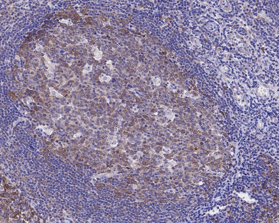 Immunohistochemistry: HN1 Antibody (JE55-74) [NBP3-32438] - Immunohistochemical analysis of paraffin-embedded human tonsil tissue with Rabbit anti-HN1 antibody (NBP3-32438) at 1/200 dilution. The section was pre-treated using heat mediated antigen retrieval with sodium citrate buffer (pH 6.0) for 2 minutes. The tissues were blocked in 1% BSA for 20 minutes at room temperature, washed with ddH2O and PBS, and then probed with the primary antibody (NBP3-32438) at 1/200 dilution for 1 hour at room temperature. The detection was performed using an HRP conjugated compact polymer system. DAB was used as the chromogen. Tissues were counterstained with hematoxylin and mounted with DPX.