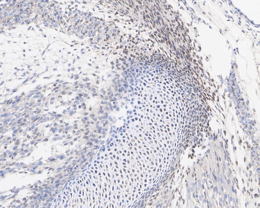 Immunohistochemistry: HOXB4 Antibody (JE36-65) [NBP3-32440] - Immunohistochemical analysis of paraffin-embedded mouse embryo cartilage tissue with Rabbit anti-HOXB4 antibody (NBP3-32440) at 1/200 dilution. The section was pre-treated using heat mediated antigen retrieval with sodium citrate buffer (pH 6.0) for 2 minutes. The tissues were blocked in 1% BSA for 20 minutes at room temperature, washed with ddH2O and PBS, and then probed with the primary antibody (NBP3-32440) at 1/200 dilution for 1 hour at room temperature. The detection was performed using an HRP conjugated compact polymer system. DAB was used as the chromogen. Tissues were counterstained with hematoxylin and mounted with DPX.