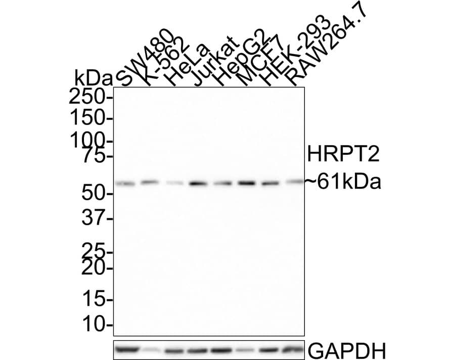 Western Blot: CDC73/HRPT2 Antibody (JE66-42) [NBP3-32442] - Western blot analysis of CDC73/HRPT2 on different lysates with Rabbit anti-CDC73/HRPT2 antibody (NBP3-32442) at 1/1,000 dilution. Lane 1: SW480 cell lysate Lane 2: K-562 cell lysate Lane 3: HeLa cell lysate Lane 4: Jurkat cell lysate Lane 5: HepG2 cell lysate Lane 6: MCF7 cell lysate Lane 7: HEK-293 cell lysate Lane 8: RAW264.7 cell lysate Lysates/proteins at 15 ug/Lane. Predicted band size: 61 kDa Observed band size: 61 kDa Exposure time: 3 minutes; 4-20% SDS-PAGE gel. Proteins were transferred to a PVDF membrane and blocked with 5% NFDM/TBST for 1 hour at room temperature. The primary antibody (NBP3-32442) at 1/1,000 dilution was used in 5% NFDM/TBST at room temperature for 2 hours. Goat Anti-Rabbit IgG - HRP Secondary Antibody at 1:100,000 dilution was used for 1 hour at room temperature.