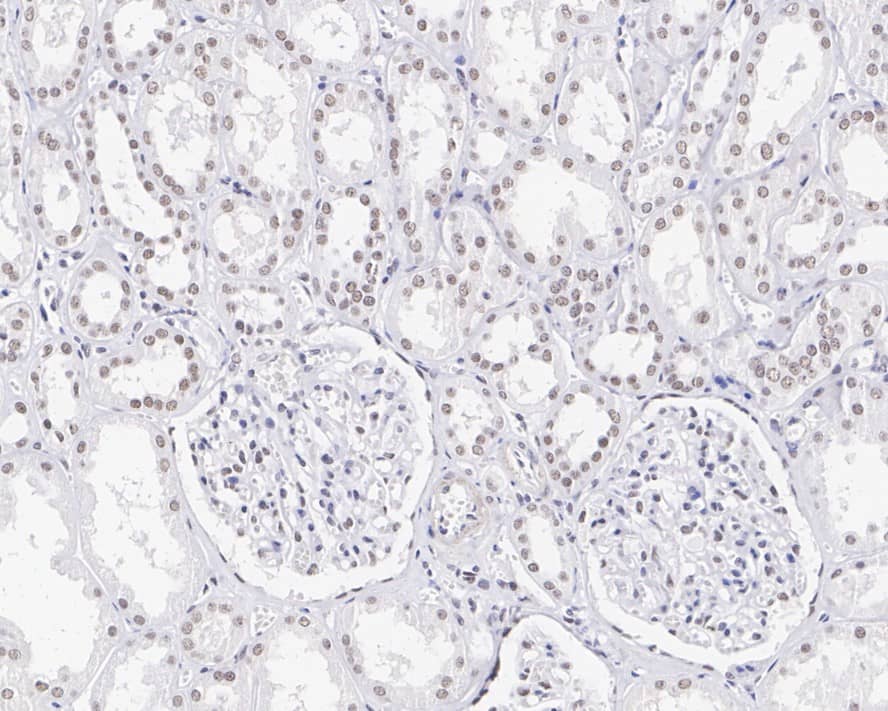 Immunohistochemistry: CDC73/HRPT2 Antibody (JE66-42) [NBP3-32442] - Immunohistochemical analysis of paraffin-embedded human kidney tissue with Rabbit anti-CDC73/HRPT2 antibody (NBP3-32442) at 1/200 dilution. The section was pre-treated using heat mediated antigen retrieval with sodium citrate buffer (pH 6.0) for 2 minutes. The tissues were blocked in 1% BSA for 20 minutes at room temperature, washed with ddH2O and PBS, and then probed with the primary antibody (NBP3-32442) at 1/200 dilution for 1 hour at room temperature. The detection was performed using an HRP conjugated compact polymer system. DAB was used as the chromogen. Tissues were counterstained with hematoxylin and mounted with DPX.