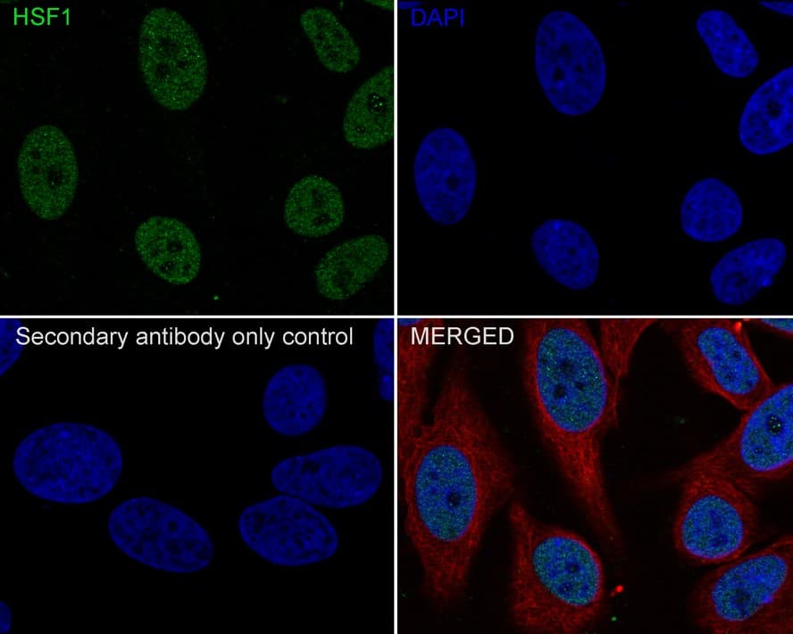 Immunocytochemistry/ Immunofluorescence: HSF1 Antibody (JE44-79) [NBP3-32444] - Immunocytochemistry analysis of HeLa cells labeling HSF1 with Rabbit anti-HSF1 antibody (NBP3-32444) at 1/100 dilution. Cells were fixed in 4% paraformaldehyde for 10 minutes at 37 ℃, permeabilized with 0.05% Triton X-100 in PBS for 20 minutes, and then blocked with 2% negative goat serum for 30 minutes at room temperature. Cells were then incubated with Rabbit anti-HSF1 antibody (NBP3-32444) at 1/100 dilution in 2% negative goat serum overnight at 4 ℃. Goat Anti-Rabbit IgG H&L (iFluor™ 488) was used as the secondary antibody at 1/1,000 dilution. Nuclear DNA was labelled in blue with DAPI. Beta tubulin (red) was stained at 1/200 dilution overnight at +4℃. Goat Anti-Mouse IgG H&L (iFluor™ 594) was used as the secondary antibody at 1/1,000 dilution.