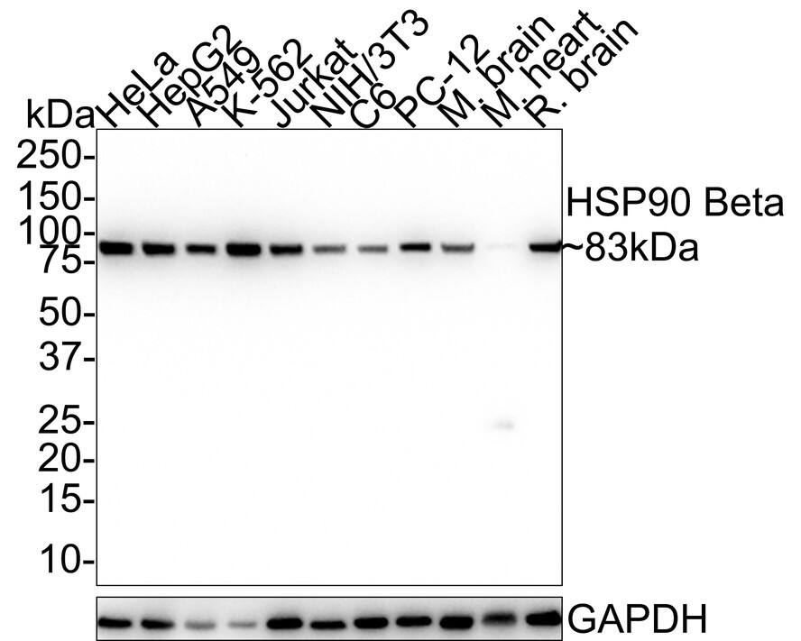 Western blot analysis on different lysates with NBP3-32446 at 1/1,000 dilution. Lane 1: HeLa cell lysate (20 µg/Lane) Lane 2: HepG2 cell lysate (20 µg/Lane) Lane 3: A549 cell lysate (20 µg/Lane) Lane 4: K-562 cell lysate (20 µg/Lane) Lane 5: Jurkat cell lysate (20 µg/Lane) Lane 6: NIH/3T3 cell lysate (20 µg/Lane) Lane 7: C6 cell lysate (20 µg/Lane) Lane 8: PC-12 cell lysate (20 µg/Lane) Lane 9: Mouse brain tissue lysate (40 µg/Lane) Lane 10: Mouse heart tissue lysate (40 µg/Lane) Lane 11: Rat brain tissue lysate (40 µg/Lane) Predicted band size: 83 kDa Observed band size: 83 kDa Exposure time: 53 seconds; 4-20% SDS-PAGE gel. Proteins were transferred to a PVDF membrane and blocked with 5% NFDM/TBST for 1 hour at room temperature. NBP3-32446 at 1/1,000 dilution was used in 5% NFDM/TBST at room temperature for 2 hours. Goat anti-Mouse IgG [HRP] at 1/100,000 dilution was used for 1 hour at room temperature.