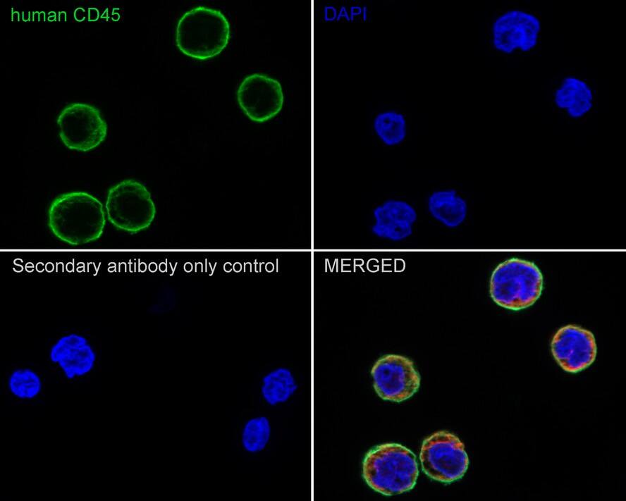 Immunocytochemistry/ Immunofluorescence: CD45 Antibody (PSH03-64) [NBP3-32448] - Immunocytochemistry analysis of Raji cells labeling CD45 with Mouse anti-CD45 antibody (NBP3-32448) at 1/100 dilution. Cells were fixed in 4% paraformaldehyde for 20 minutes at room temperature, permeabilized with 0.1% Triton X-100 in PBS for 5 minutes at room temperature, then blocked with 1% BSA in 10% negative goat serum for 1 hour at room temperature. Cells were then incubated with Mouse anti-CD45 antibody (NBP3-32448) at 1/100 dilution in 1% BSA in PBST overnight at 4 ℃. Goat Anti-Mouse IgG H&L (iFluor™ 488) was used as the secondary antibody at 1/1,000 dilution. PBS instead of the primary antibody was used as the secondary antibody only control. Nuclear DNA was labelled in blue with DAPI. beta Tubulin (red) was stained at 1/100 dilution overnight at +4℃. Goat Anti-Rabbit IgG H&L (iFluor™ 594) were used as the secondary antibody at 1/1,000 dilution.