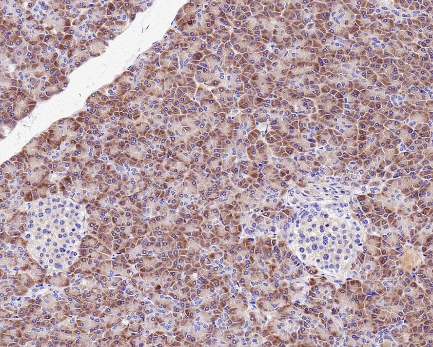 Immunohistochemistry: TNF-alpha Antibody (PS00-40) [NBP3-32454] - Immunohistochemical analysis of paraffin-embedded human pancreas tissue with Rabbit anti-Human TNF-alpha antibody (NBP3-32454) at 1/200 dilution. The section was pre-treated using heat mediated antigen retrieval with Tris-EDTA buffer (pH 9.0) for 20 minutes. The tissues were blocked in 1% BSA for 20 minutes at room temperature, washed with ddH2O and PBS, and then probed with the primary antibody (NBP3-32454) at 1/200 dilution for 1 hour at room temperature. The detection was performed using an HRP conjugated compact polymer system. DAB was used as the chromogen. Tissues were counterstained with hematoxylin and mounted with DPX.