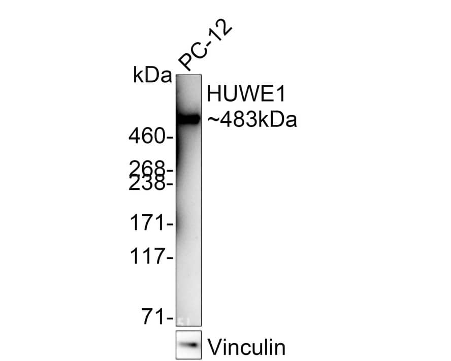 Western Blot: HUWE1 Antibody (PSH02-38) [NBP3-32455] - Western blot analysis of HUWE1 on PC-12 cell lysates with Rabbit anti-HUWE1 antibody (NBP3-32455) at 1/1,000 dilution. Lysates/proteins at 20 ug/Lane. Predicted band size: 482.7 kDa Observed band size: 482.7 kDa Exposure time: 5 minutes; 4-20% SDS-PAGE gel. Proteins were transferred to a PVDF membrane and blocked with 5% NFDM/TBST for 1 hour at room temperature. The primary antibody (NBP3-32455) at 1/1,000 dilution was used in 5% NFDM/TBST at 4  overnight. Goat Anti-Rabbit IgG - HRP Secondary Antibody at 1/50,000 dilution was used for 1 hour at room temperature.