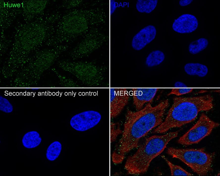 Immunocytochemistry/ Immunofluorescence: HUWE1 Antibody (PSH02-38) [NBP3-32455] - Immunocytochemistry analysis of HeLa cells labeling HUWE1 with Rabbit anti-HUWE1 antibody (NBP3-32455) at 1/100 dilution. Cells were fixed in 4% paraformaldehyde for 20 minutes at room temperature, permeabilized with 0.1% Triton X-100 in PBS for 5 minutes at room temperature, then blocked with 1% BSA in 10% negative goat serum for 1 hour at room temperature. Cells were then incubated with Rabbit anti-HUWE1 antibody (NBP3-32455) at 1/100 dilution in 1% BSA in PBST overnight at 4 ℃. Goat Anti-Rabbit IgG H&L (iFluor™ 488) was used as the secondary antibody at 1/1,000 dilution. PBS instead of the primary antibody was used as the secondary antibody only control. Nuclear DNA was labelled in blue with DAPI. Beta tubulin (red) was stained at 1/100 dilution overnight at +4℃. Goat Anti-Mouse IgG H&L (iFluor™ 594) was used as the secondary antibody at 1/1,000 dilution.