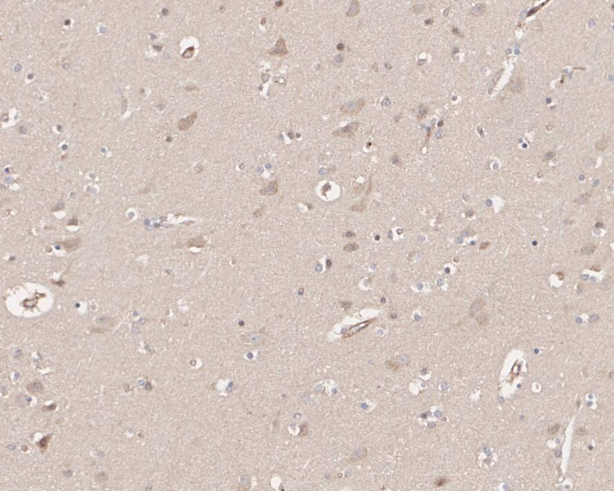 Immunohistochemistry: HUWE1 Antibody (PSH02-38) [NBP3-32455] - Immunohistochemical analysis of paraffin-embedded human brain tissue with Rabbit anti-HUWE1 antibody (NBP3-32455) at 1/1,000 dilution. The section was pre-treated using heat mediated antigen retrieval with sodium citrate buffer (pH 6.0) for 2 minutes. The tissues were blocked in 1% BSA for 20 minutes at room temperature, washed with ddH2O and PBS, and then probed with the primary antibody (NBP3-32455) at 1/1,000 dilution for 1 hour at room temperature. The detection was performed using an HRP conjugated compact polymer system. DAB was used as the chromogen. Tissues were counterstained with hematoxylin and mounted with DPX.