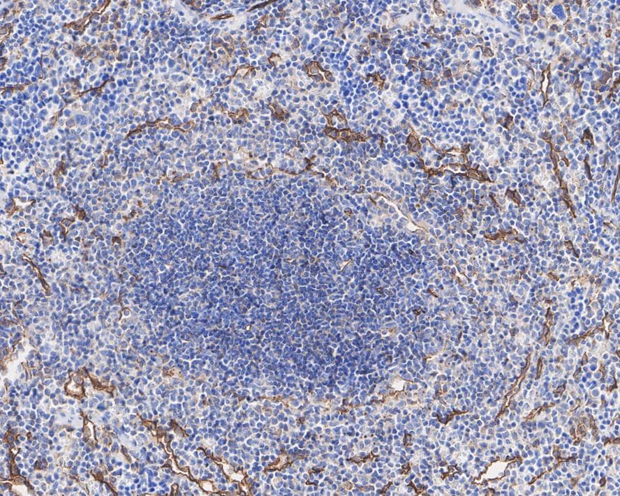 Immunohistochemistry: ICAM-2/CD102 Antibody (JE63-28) [NBP3-32456] - Immunohistochemical analysis of paraffin-embedded mouse spleen tissue with Rabbit anti-ICAM-2/CD102 antibody (NBP3-32456) at 1/500 dilution. The section was pre-treated using heat mediated antigen retrieval with Tris-EDTA buffer (pH 9.0) for 20 minutes. The tissues were blocked in 1% BSA for 20 minutes at room temperature, washed with ddH2O and PBS, and then probed with the primary antibody (NBP3-32456) at 1/500 dilution for 1 hour at room temperature. The detection was performed using an HRP conjugated compact polymer system. DAB was used as the chromogen. Tissues were counterstained with hematoxylin and mounted with DPX.