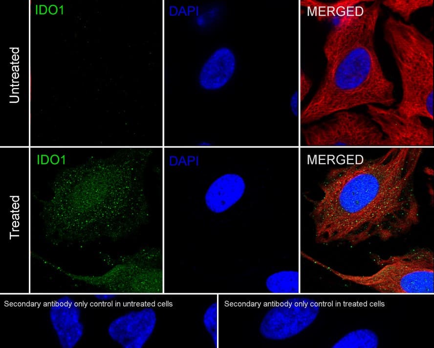 Immunocytochemistry/ Immunofluorescence: Indoleamine 2,3-dioxygenase/IDO Antibody (PD00-62) [NBP3-32457] - Immunocytochemistry analysis of HeLa cells treated with or without 50 ng/mL IFN-gamma for 16 hours labeling Indoleamine 2,3-dioxygenase/IDO with Rabbit anti-Indoleamine 2,3-dioxygenase/IDO antibody (NBP3-32457) at 1/100 dilution. Cells were fixed in 4% paraformaldehyde for 20 minutes at room temperature, permeabilized with 0.1% Triton X-100 in PBS for 5 minutes at room temperature, then blocked with 1% BSA in 10% negative goat serum for 1 hour at room temperature. Cells were then incubated with Rabbit anti-Indoleamine 2,3-dioxygenase/IDO antibody (NBP3-32457) at 1/100 dilution in 1% BSA in PBST overnight at 4 ℃. Goat Anti-Rabbit IgG H&L (iFluor™ 488) was used as the secondary antibody at 1/1,000 dilution. PBS instead of the primary antibody was used as the secondary antibody only control. Nuclear DNA was labelled in blue with DAPI. Beta tubulin (red) was stained at 1/100 dilution overnight at +4℃. Goat Anti-Mouse IgG H&L (iFluor™ 594) was used as the secondary antibody at 1/1,000 dilution.