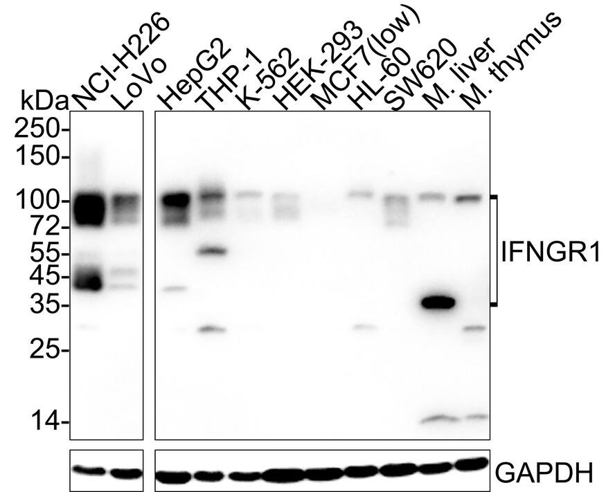 Western blot analysis on different lysates with NBP3-32458 at 1/1,000 dilution. Lane 1: NCI-H226 cell lysate (20 µg/Lane) Lane 2: LoVo cell lysate (20 µg/Lane) Lane 3: HepG2 cell lysate (20 µg/Lane) Lane 4: THP-1 cell lysate (20 µg/Lane) Lane 5: K-562 cell lysate (20 µg/Lane) Lane 6: HEK-293 cell lysate (20 µg/Lane) Lane 7: MCF7 cell lysate (low expression) (20 µg/Lane) Lane 8: HL-60 cell lysate (20 µg/Lane) Lane 9: SW620 cell lysate (20 µg/Lane) Lane 10: Mouse liver tissue lysate (40 µg/Lane) Lane 11: Mouse thymus tissue lysate (40 µg/Lane) Predicted band size: 54 kDa Observed band size: 40-100 kDa Exposure time: 1 minute 2 seconds;  4-20% SDS-PAGE gel. Proteins were transferred to a PVDF membrane and blocked with 5% NFDM/TBST for 1 hour at room temperature. NBP3-32458 at 1/1,000 dilution was used in 5% NFDM/TBST at 4℃ overnight. Goat Anti-Rabbit IgG [HRP] Secondary Antibody at 1/50,000 dilution was used for 1 hour at room temperature.